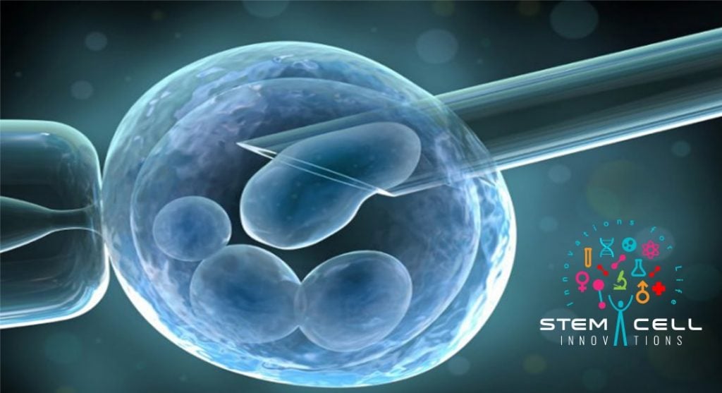 Stem Cell Innovations